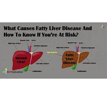 How To Get Liver To Burn Fat